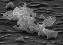 Microscopy image of microbes.