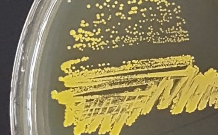 Microbes streaked on a plate. 