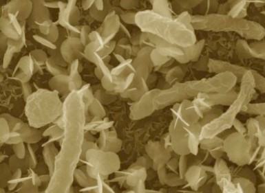 close up image of microbes