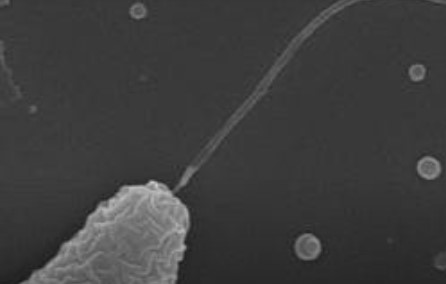 close up image of a microbe with a flagellum.