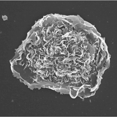 Black and white image of an alveolar macrophage