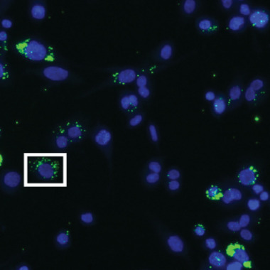 Dark blue phages are shown with bright green Brucella glowing inside of them. 