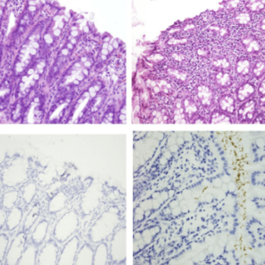 Four squares show cells in the ferret intestines. The square on the top are purple and white, and the square on the bottom are a light blue and white. 