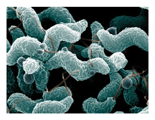 Scanning electron microscope image of campylobacter jejuni