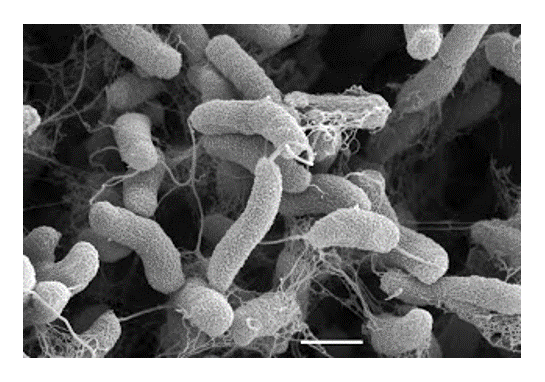 Scanning electron microscope image of Vibrio cholerae