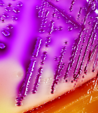 A macro shot of white agar with purple streaking.