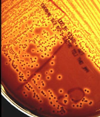 The image is a close-up shot of GBS hemolysis. It's a macro shot of a red agar with dark dots and yellow streaking.