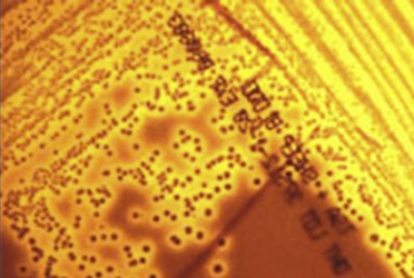 close up of microbes on a plate.